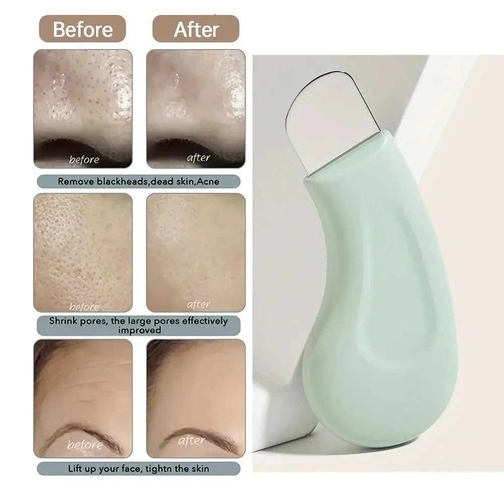 Herramienta de Limpieza Profun - Skincare Routine reseña y precio