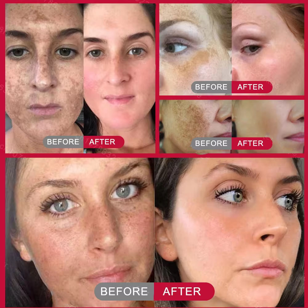Potente Crema Blanqueadora par - Skincare Vitamin C reseña y precio