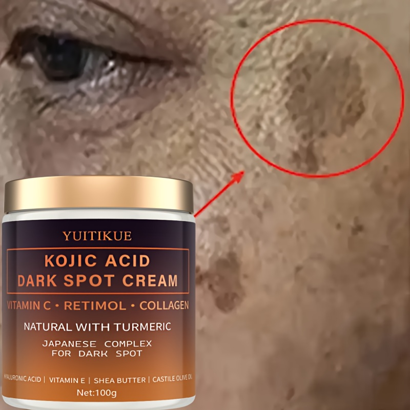 Crema decolorante de arbutina, - Skincare Vitamin C reseña y precio